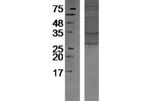Mouse bone lysates probed with Rabbit Anti-Glycophorin C Polyclonal Antibody, Unconjugated  at 1:300 overnight at 4˚C. (CD236/GYPC 抗体  (AA 31-128))