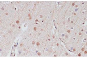 Immunohistochemistry of paraffin-embedded Rat brain using CREB1 Polyclonal Antibody at dilution of 1:100 (40x lens). (CREB1 抗体)