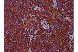 IHC image of ABIN7150062 diluted at 1:400 and staining in paraffin-embedded human lymph node tissue performed on a Leica BondTM system. (ADAM8 抗体  (AA 677-824))