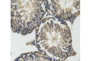Used in DAB staining on fromalin fixed paraffin- embedded testis tissue (SEMA4D/CD100 抗体  (AA 502-636))