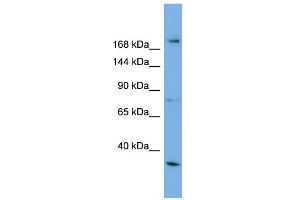 WB Suggested Anti-ALS2 Antibody Titration: 0. (ALS2 抗体  (Middle Region))