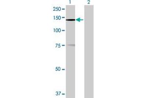 Western Blot analysis of MPHOSPH9 expression in transfected 293T cell line by MPHOSPH9 MaxPab polyclonal antibody. (MPHOSPH9 抗体  (AA 1-1031))