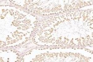 Immunohistochemistry (Paraffin-embedded Sections) (IHC (p)) image for anti-Nuclear RNA Export Factor 2 (NXF2) antibody (ABIN7074901)
