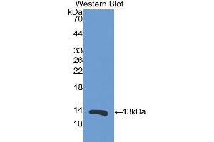 Western blot analysis of the recombinant protein. (S100A11 抗体  (AA 1-102))