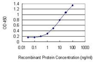 Detection limit for recombinant GST tagged SOD1 is 0. (SOD1 抗体  (AA 1-154))