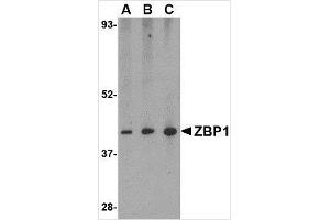 Western blot analysis of ZBP1 in mouse small intestine tissue lysate with ZBP1 antibody at (A) 0. (ZBP1 抗体  (C-Term))