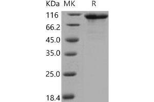 Western Blotting (WB) image for Fibroblast Growth Factor Receptor 4 (FGFR4) (Active) protein (His tag,Fc Tag) (ABIN7320372)
