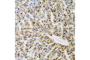 Immunohistochemistry (IHC) image for anti-Neurotrophic Tyrosine Kinase, Receptor, Type 1 (NTRK1) (C-Term) antibody (ABIN7268895)