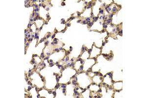 Immunohistochemistry of paraffin-embedded Mouse lung using TPP2 antibody at dilution of 1:100 (x400 lens). (Tpp2 抗体)