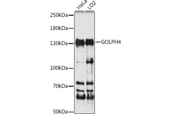 Golgi Integral Membrane Protein 4 (GOLIM4) (AA 34-300) 抗体