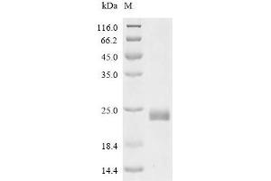 (Tris-Glycine gel) Discontinuous SDS-PAGE (reduced) with 5 % enrichment gel and 15 % separation gel.