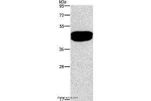 Western blot analysis of Human prostate tissue, using SDCCAG3 Polyclonal Antibody at dilution of 1:500