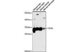 Western blot analysis of extracts of various cell lines, using SDSL antibody (ABIN7270209) at 1:1000 dilution. (SDSL 抗体  (AA 1-137))