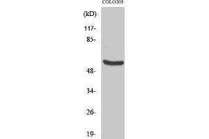 Western Blot analysis of COLO205 cells using HSP60 Polyclonal Antibody diluted at 1:2000.