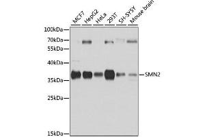 Western blot analysis of extracts of various cell lines, using SMN2 antibody. (SMN2 抗体  (AA 1-197))