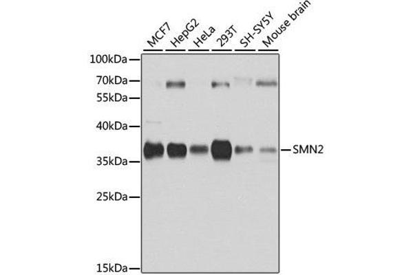 SMN2 抗体  (AA 1-197)