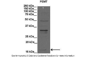 Lanes:   Lane1: 20 ug rat liver lysate  Primary Antibody Dilution:   1:2000  Secondary Antibody:   Anti-rabbit HRP  Secondary Antibody Dilution:   1:15000  Gene Name:   PEMT  Submitted by:   Anonymous (PEMT 抗体  (C-Term))