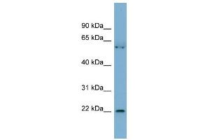 WB Suggested Anti-SLMO2 Antibody Titration: 0. (SLMO2 抗体  (N-Term))