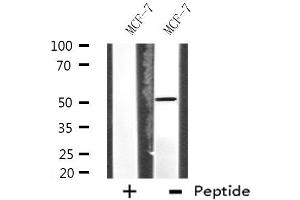 Western blot analysis of extracts from MCF-7 cells, using HUCE1 antibody. (RRP8 抗体  (Internal Region))