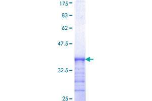 SDCBP Protein (AA 1-100) (GST tag)