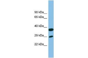 WB Suggested Anti-RTP4 Antibody Titration: 0. (RTP4 抗体  (Middle Region))