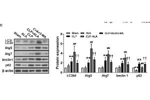 Effects of ALA on cardiac function, inflammation and autophagy in CLP-induced septic rats. (ATG5 抗体  (AA 1-275))