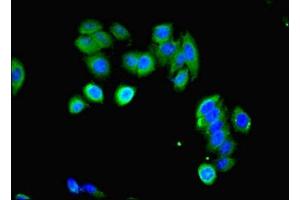 Immunofluorescent analysis of HepG2 cells using ABIN7158591 at dilution of 1:100 and Alexa Fluor 488-congugated AffiniPure Goat Anti-Rabbit IgG(H+L) (LHCGR 抗体  (AA 27-363))