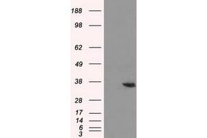 Western Blotting (WB) image for anti-Aldo-Keto Reductase Family 1, Member A1 (Aldehyde Reductase) (AKR1A1) antibody (ABIN1496539) (AKR1A1 抗体)