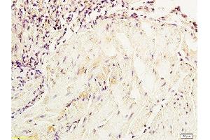Formalin-fixed and paraffin embedded dog bladder tissue labeled with Anti-NSE/ENO2/γ Enolase Polyclonal Antibody, Unconjugated  at 1:800, followed by conjugation to the secondary antibody and DAB staining (ENO2/NSE 抗体  (AA 201-300))