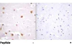Immunohistochemical analysis of paraffin-embedded human brain tissue using CSNK2B polyclonal antibody . (CSNK2B 抗体  (Ser209))