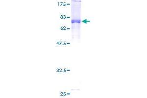 STK24 Protein (AA 1-431) (GST tag)
