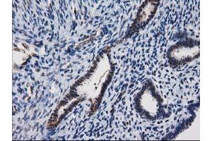 Image no. 5 for anti-Nonhomologous End-Joining Factor 1 (NHEJ1) antibody (ABIN1499728)