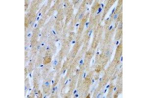 Immunohistochemical analysis of GlyRS staining in rat heart formalin fixed paraffin embedded tissue section. (GlyRS 抗体)