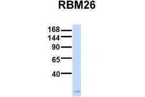Host:  Rabbit  Target Name:  RBM26  Sample Type:  Human Fetal Brain  Antibody Dilution:  1. (RBM26 抗体  (Middle Region))