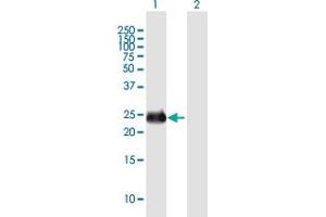 Western Blot analysis of INS-IGF2 expression in transfected 293T cell line by INS-IGF2 MaxPab polyclonal antibody. (INS-IGF2 抗体  (AA 1-200))