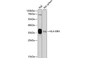Western blot analysis of extracts of various cell lines, using HLA-DRA antibody (ABIN6131757, ABIN6141827, ABIN6141829 and ABIN6215475) at 1:1000 dilution. (HLA-DRA 抗体  (AA 26-216))