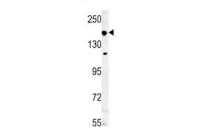 IF Antibody (N-term) (ABIN651581 and ABIN2840310) western blot analysis in mouse lung tissue lysates (35 μg/lane). (IFT172 抗体  (N-Term))