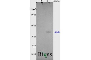 L1 rat brain, L2 , human colon carcinoma lysates probed (ABIN728773) at 1:200 in 4 °C. (OCT4 抗体  (AA 201-300))