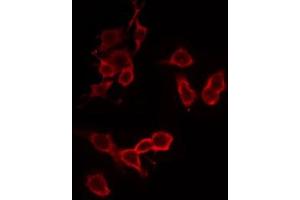 Immunofluorescence (fixed cells) (IF/ICC) image for anti-ATP Synthase, H+ Transporting, Mitochondrial F1 Complex, gamma Polypeptide 1 (ATP5C1) (Internal Region) antibody (ABIN6257083)