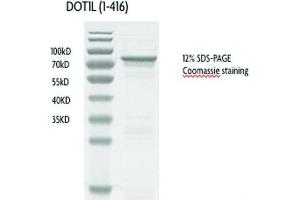 Western Blotting (WB) image for DOT1-Like, Histone H3 Methyltransferase (S. Cerevisiae) (DOT1L) (AA 1-416) (Active) protein (GST tag) (ABIN2669718)