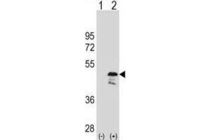 Western Blotting (WB) image for anti-Obg-Like ATPase 1 (OLA1) antibody (ABIN2998785) (OLA1 抗体)