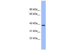 ACMSD antibody used at 1 ug/ml to detect target protein. (ACMSD 抗体  (Middle Region))