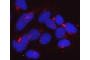 IF analysis of Golgin 97/GOLGA1 using anti-Golgin 97/GOLGA1 antibody (ABIN7599538).