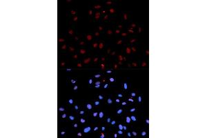 Immunofluorescence analysis of U2OS cells using Phospho-MET-Y1235 antibody (ABIN5969924). (c-MET 抗体  (pTyr1235))