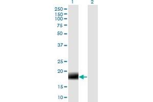 Western Blot analysis of 2-Mar expression in transfected 293T cell line by MARCH2 monoclonal antibody (M04), clone 7F3. (MARCH2 抗体  (AA 1-176))