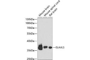 Western blot analysis of extracts of various cell lines, using EL antibody (ABIN6134651, ABIN6140118, ABIN6140119 and ABIN6221704) at 1:1000 dilution.