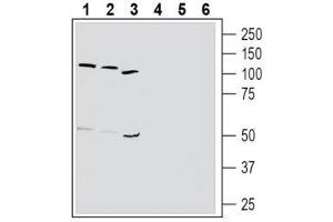 Western blot analysis of human K562 chronic myelogenous leukemia cell line lysate (lanes 1 and 4), human HL-60 promyelocytic leukemia cell line lysate (lanes 2 and 5) and human MEG-01 megakaryoblastic leukemia cell line lysate (lanes 3 and 6): - 1-3. (TBXA2R 抗体  (Extracellular, N-Term))