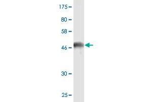 Western Blot detection against Immunogen (47. (HSPB8 抗体  (AA 1-196))