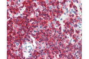 Anti-CD45RA antibody IHC of human spleen. (CD45RA 抗体  (FITC))