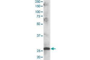 CLPP polyclonal antibody  staining (1 ug/mL) of human muscle lysate (RIPA buffer, 35 ug total protein per lane). (CLPP 抗体)